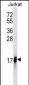 HMGN2 Antibody (N-term)