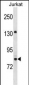 UHRF2 Antibody (Center)