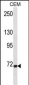 FZD3 Antibody (C-term)