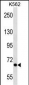 ALS2CR8 Antibody (N-term)