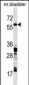 CORO1C Antibody (C-term)