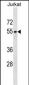 SEPT6 Antibody (C-term)