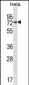 USP39 Antibody (Center)