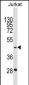 GTF3A Antibody (C-term)