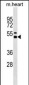 Mouse Il12b Antibody (Center)