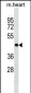 OLIG2 Antibody (Center)