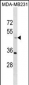 TAPBP Antibody (N-term)