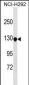 KIT Antibody (Center T274 )