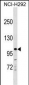 KIT Antibody (Center Y362)