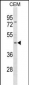 FOXP3 Antibody (C-term S418)