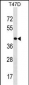 HOXD8 Antibody (C-term)