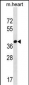 FBXO22 Antibody (C-term)