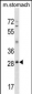 GSC Antibody (N-term)