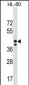 MRPS31 Antibody (Center)