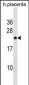 RNF122 Antibody (Center)
