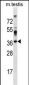 SURF4 Antibody (C-term)