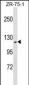 ZHX2 Antibody (N-term)