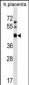 APOBEC3D Antibody (N-term)