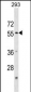 KATNA1 Antibody (N-term)