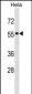 STAU1 Antibody (N-term)