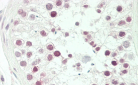 NCAPH Antibody (Center)