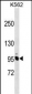 NCAPH Antibody (Center)