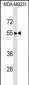 FOXQ1 Antibody (Center)