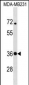 STX4 Antibody (Center)