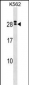 IL15RA Antibody (Center)