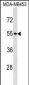 SKAP1 Antibody (C-term)