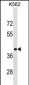 PCBP1 Antibody (Center)