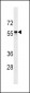 SLC22A2 Antibody (C-term)