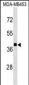 ALDOB Antibody (N-term)