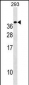 TREM1 Antibody (C-term)