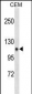 ITGA7 Antibody (N-term)