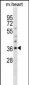 OLIG1 Antibody (C-term)