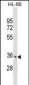 PDLIM3 Antibody (C-term)