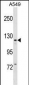 KIT Antibody (Center T354)