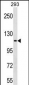 KIT Antibody (C-term Y936)