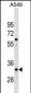 XRCC4 Antibody (Center)