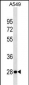 VAPB Antibody (C-term)