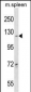 COL19A1 Antibody (N-term)