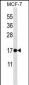 BAX  Antibody