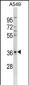 CTGF Antibody