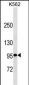 TNFRSF8/CD30 Antibody (Center) (Ascites)