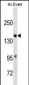 A2M Antibody (C-term) (Ascites)