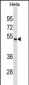 FOXA1 Antibody (Center D159) (Ascites)