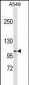 DISC1 Antibody