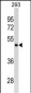 GATA4 Antibody (C-term) (Ascites)