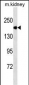 ACE Antibody (Ascites)